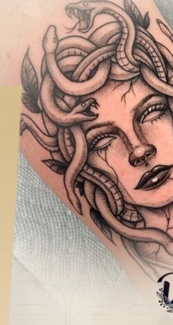 Tatuaje en proceso de remoción láser