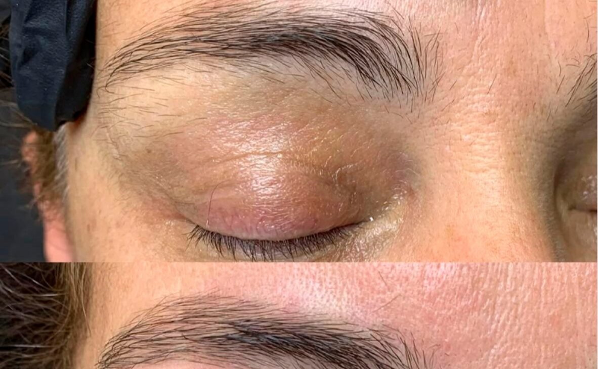 Antes y después de cejas Real Brows