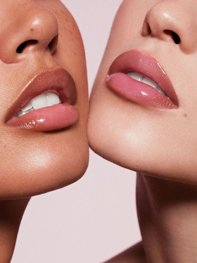 Labios con relleno natural